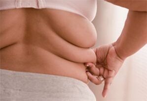 Fat folds on the side